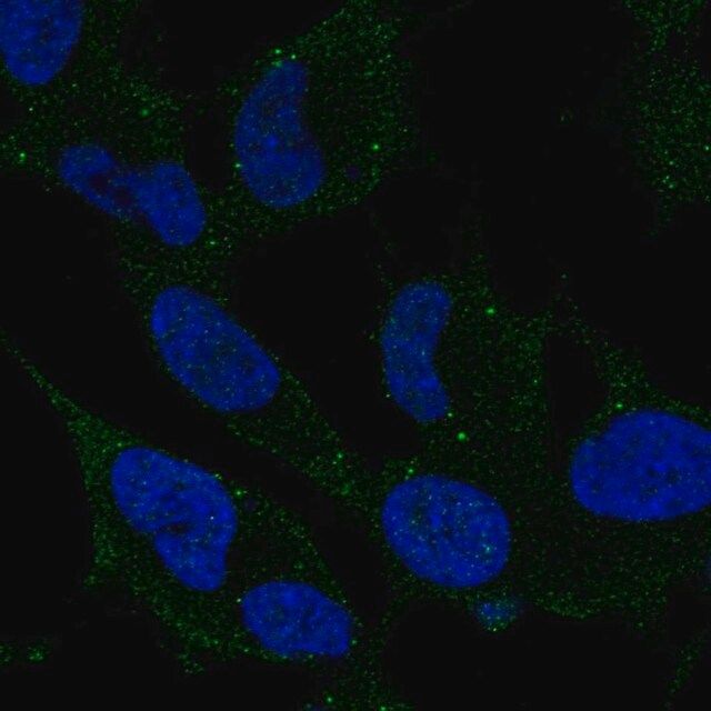 Anti-ARHGDIG antibody produced in rabbit