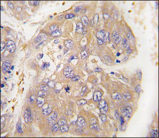 Anti-ARHGEF9 (center) antibody produced in rabbit