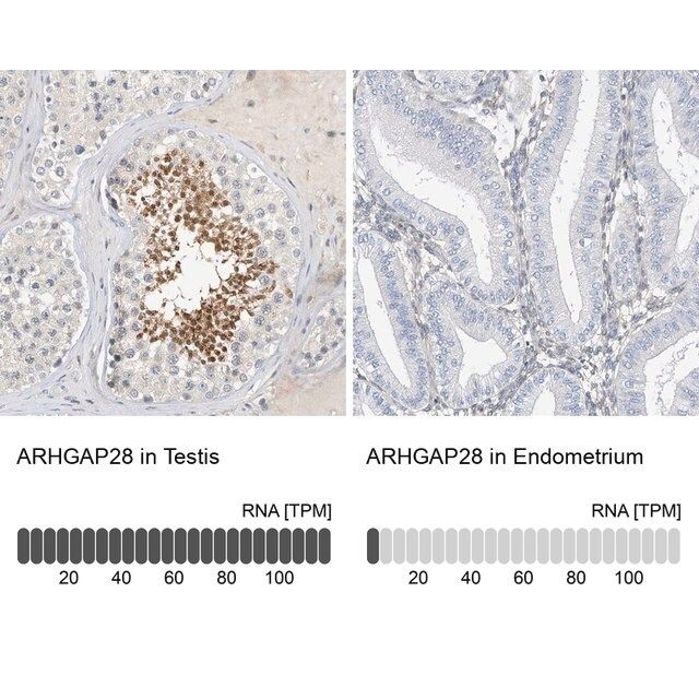 Anti-ARHGAP28 antibody produced in rabbit