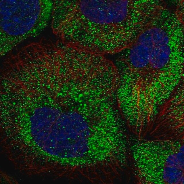 Anti-ARHGAP11A antibody produced in rabbit