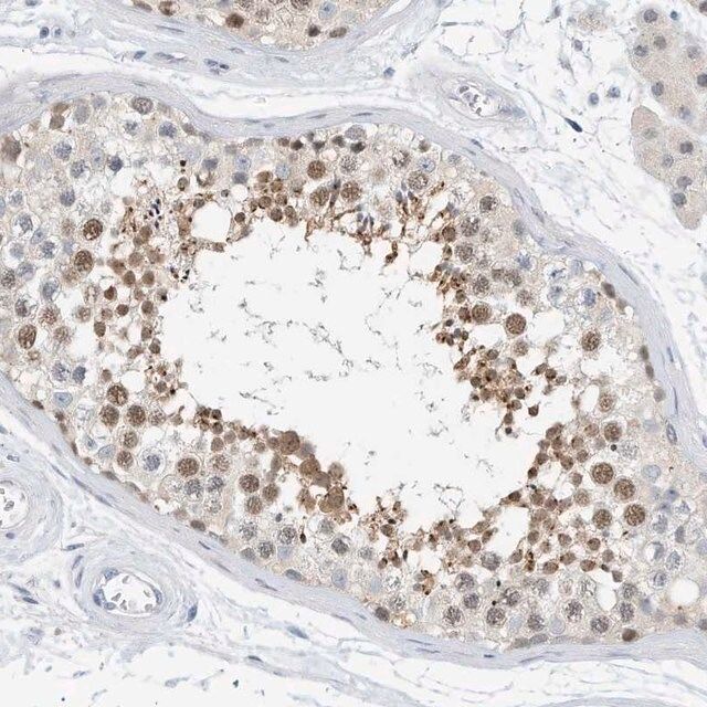 Anti-ARHGAP28 antibody produced in rabbit