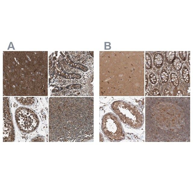 Anti-ARHGEF11 antibody produced in rabbit