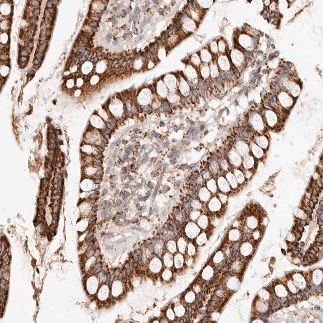 Anti-ARHGEF10L antibody produced in rabbit