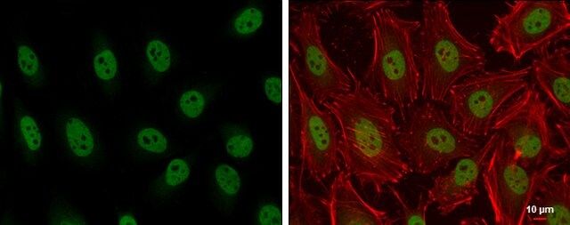 Anti-ARID2 antibody produced in rabbit