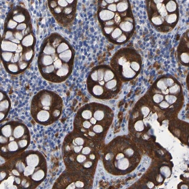 Anti-ARHGEF16 antibody produced in rabbit