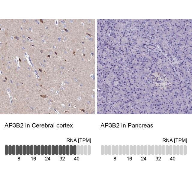 Anti-AP3B2 antibody produced in rabbit