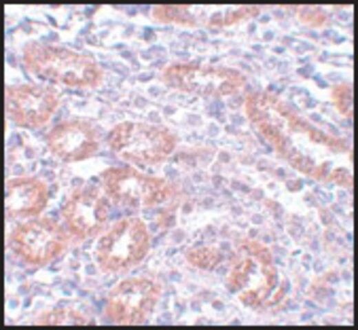 Anti-APC5 antibody produced in rabbit