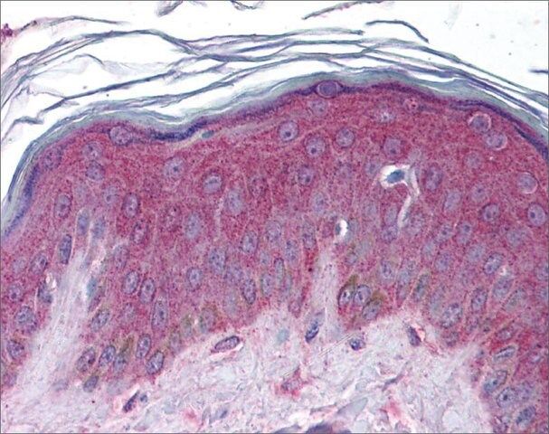 Anti-APC2 antibody produced in rabbit