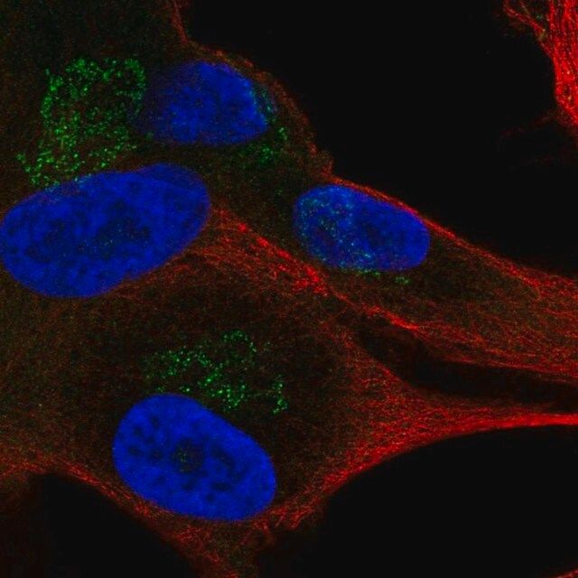 Anti-APBA1 antibody produced in rabbit