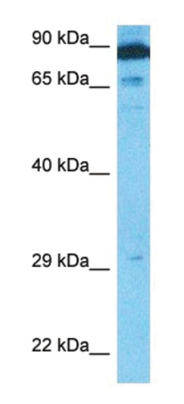 Anti-APBB1 (N-terminal) antibody produced in rabbit