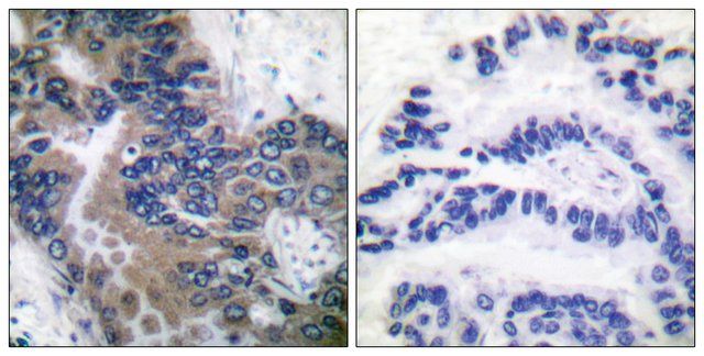 Anti-APAF-1-ALT antibody produced in rabbit