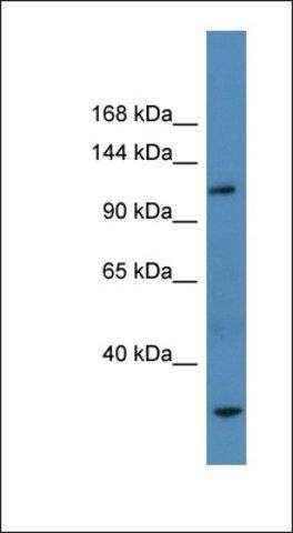 Anti-AP3B1 antibody produced in rabbit