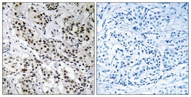 Anti-APBB2 antibody produced in rabbit