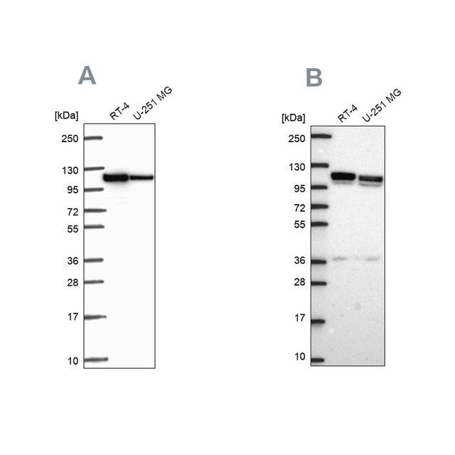 Anti-AP1B1 antibody produced in rabbit