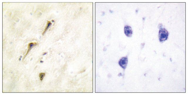 Anti-APC1 antibody produced in rabbit