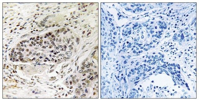 Anti-APBA2 antibody produced in rabbit