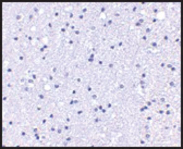 Anti-APC1 antibody produced in rabbit