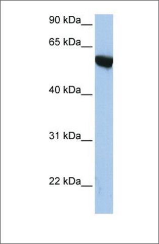 Anti-APBA3 antibody produced in rabbit