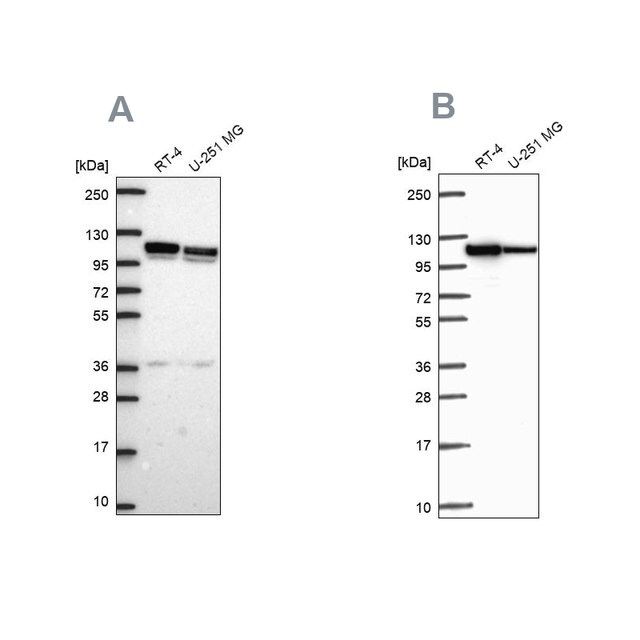 Anti-AP1B1 antibody produced in rabbit