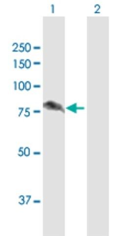 Anti-ALDH16A1 antibody produced in rabbit