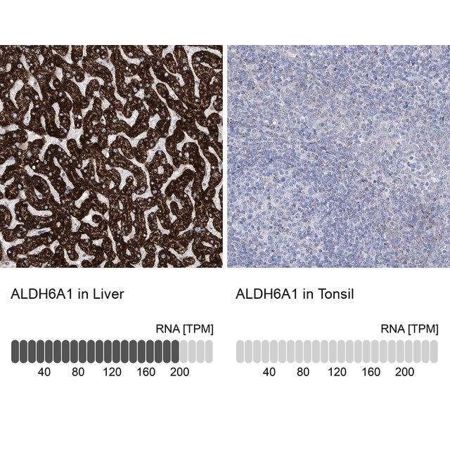 Anti-ALDH6A1 antibody produced in rabbit