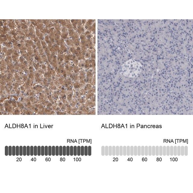 Anti-ALDH8A1 antibody produced in rabbit