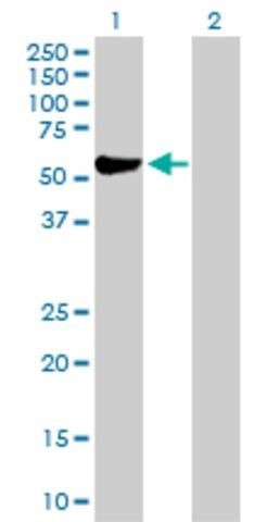 Anti-ALDH3A1 antibody produced in rabbit