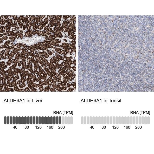 Anti-ALDH6A1 antibody produced in rabbit