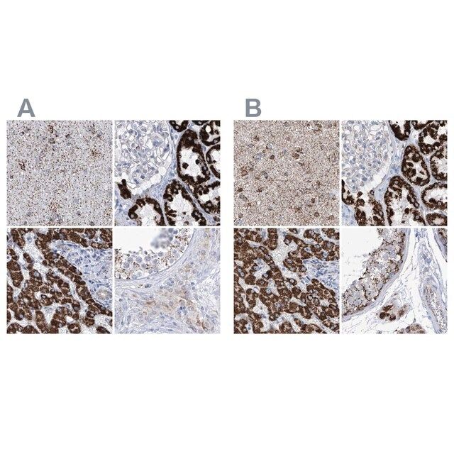 Anti-ALDH6A1 antibody produced in rabbit