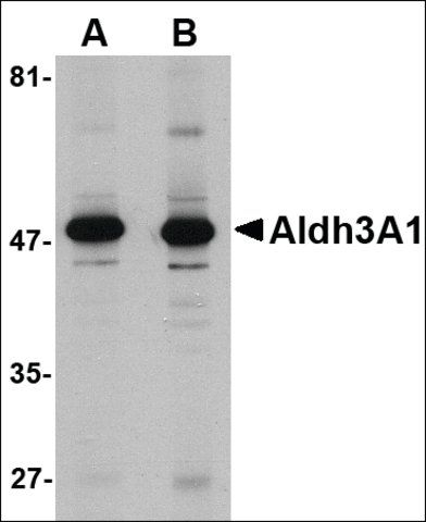 Anti-ALDH3A1 antibody produced in rabbit