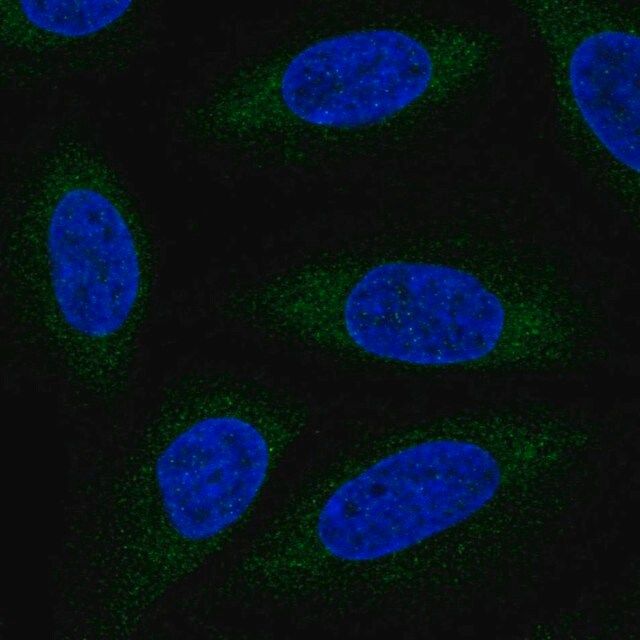 Anti-ALG6 antibody produced in rabbit