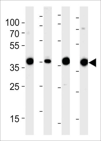 ANTI-ALDOLASE (ALDOA)(N-TERMINAL) antibody produced in rabbit