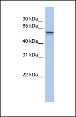 Anti-ALDH6A1 antibody produced in rabbit