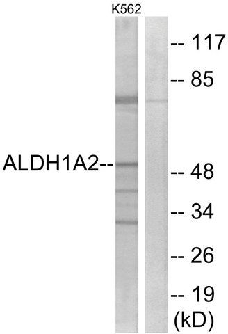 Anti-ALDH1A2 antibody produced in rabbit