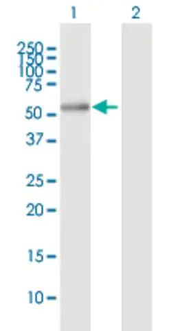 Anti-ALDH7A1 antibody produced in mouse