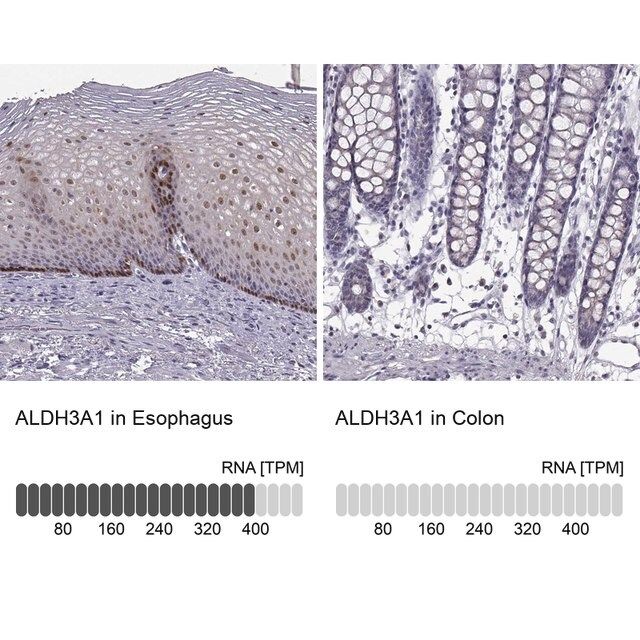 Anti-ALDH3A1 antibody produced in rabbit