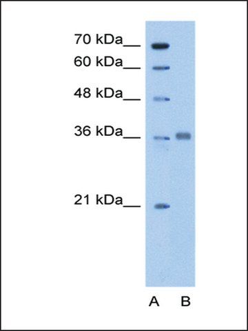 Anti-ALDOC antibody produced in rabbit