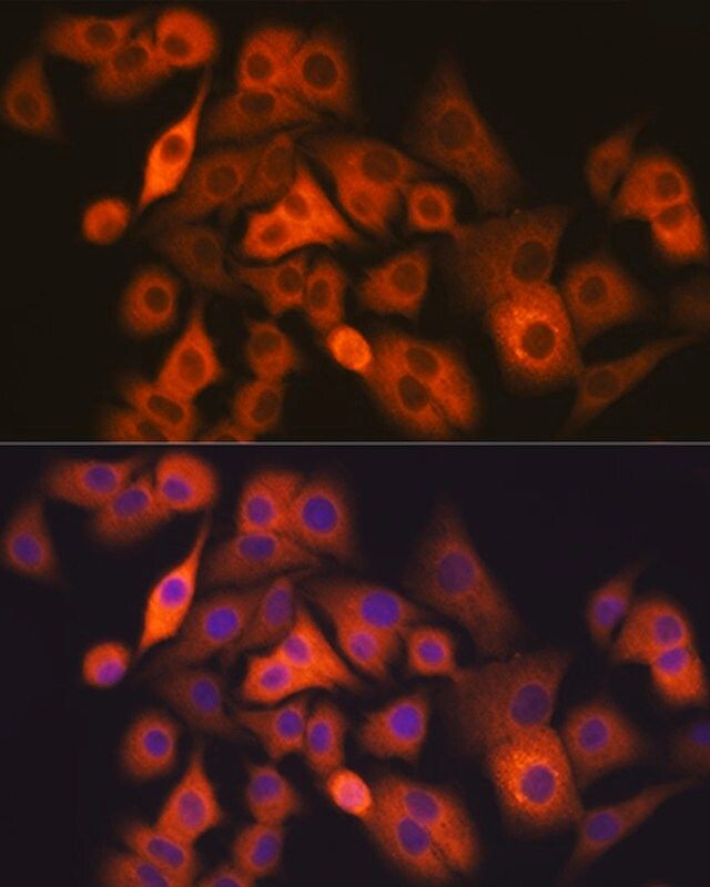 Anti-ALDH1A1 antibody produced in rabbit