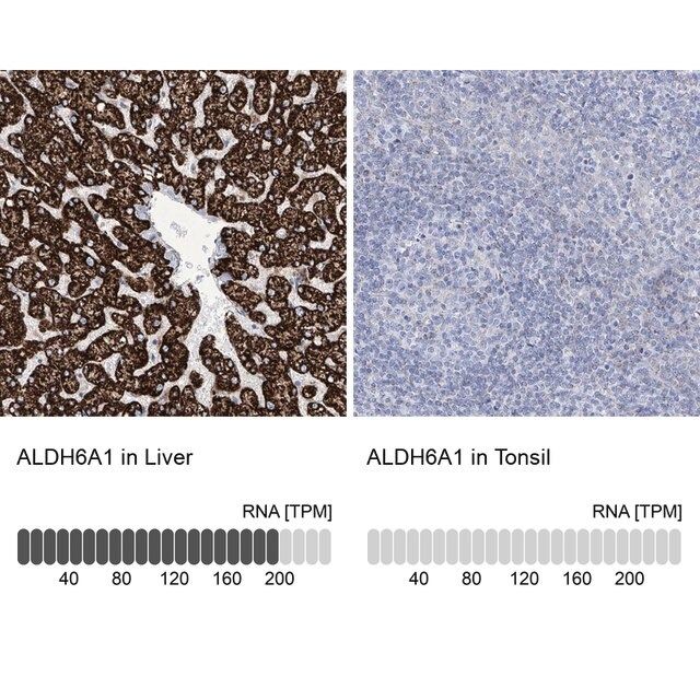 Anti-ALDH6A1 antibody produced in rabbit