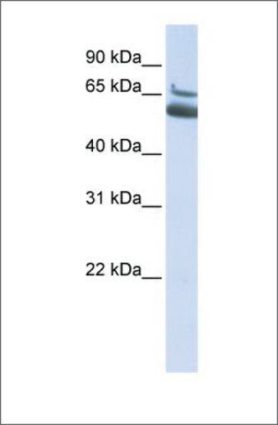 Anti-ALOX15B (ab2) antibody produced in rabbit