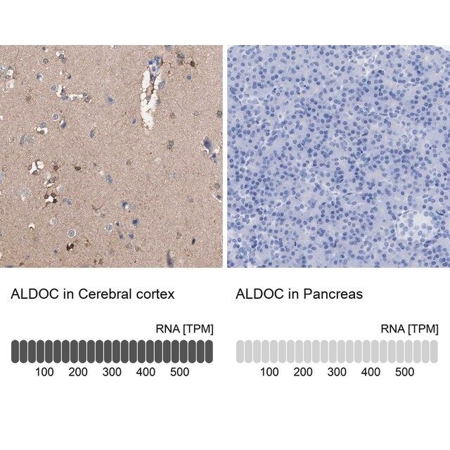 Anti-ALDOC antibody produced in rabbit