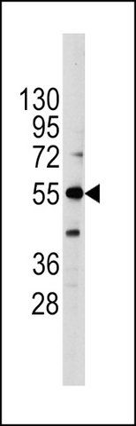 ANTI-ALKALINE PHOSPHATASE (ALPI) (CENTER antibody produced in rabbit