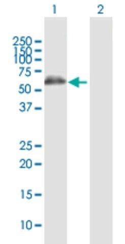 Anti-ALDH4A1 antibody produced in rabbit