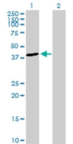 Anti-ALDOB antibody produced in rabbit