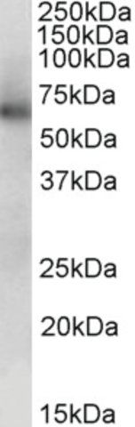 Anti-ALDH1B1 antibody produced in goat