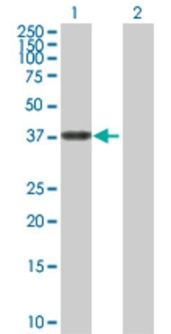 Anti-ALDH3B2 antibody produced in rabbit