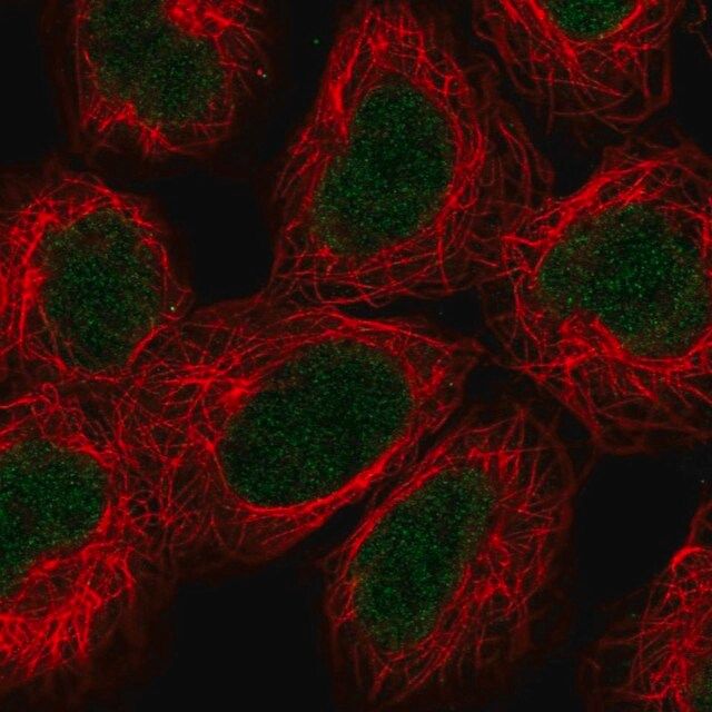 Anti-ALKBH2 antibody produced in rabbit