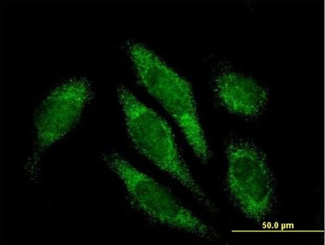 Anti-ALDH16A1 antibody produced in mouse