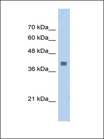 Anti-ALDOA antibody produced in rabbit