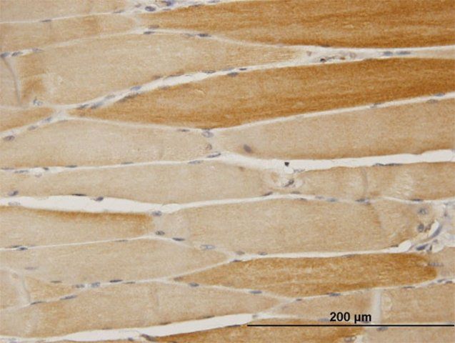 Anti-ALKBH1 antibody produced in mouse